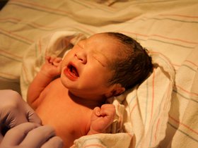 serena-get-umbilical-cord-worked-on_8064355917_o.jpg